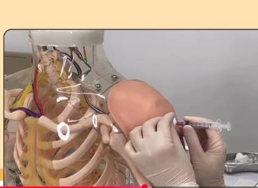 การฉีดยาเข้ากล้ามเนื้อ